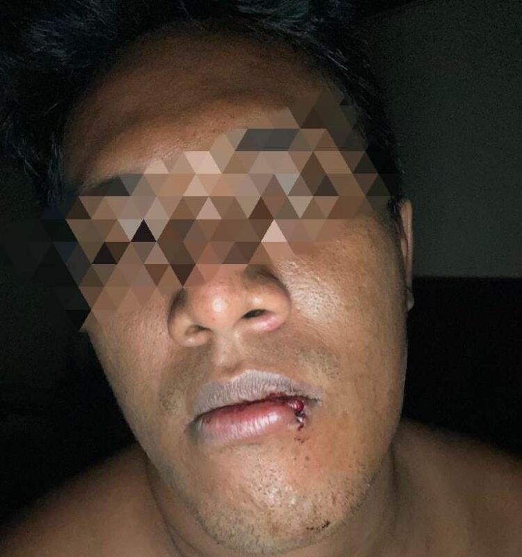 Pelaku Tindak Pidana Kekerasan Pemukulan Bebas Berkeliaran Wilayah Hukum Polsek Tanjung Raya