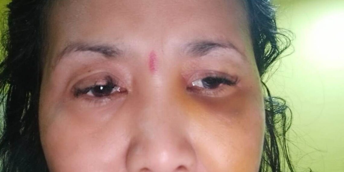 Hakim Ponis Pelaku KDRT Sam’on WNA 7 Bulan Penjara Jadi Buah Bibir