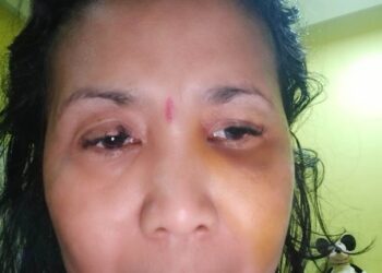 Hakim Ponis Pelaku KDRT Sam’on WNA 7 Bulan Penjara Jadi Buah Bibir