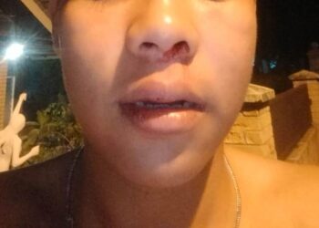 Niat Cari Pahala Bangunkan Orang Sahur Pada Ramadhan, Naasnya Kawan Dipukul Segerombolan Orang Tak Dikenal